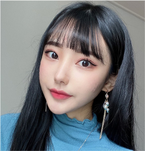 Result of jawline refinement and facial slimming after contour tox