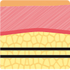 Evolution of thread lifting structure from 1st to 4th generation